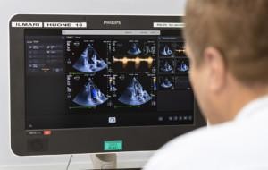 OYS Sydän osaamiskeskus, sydänlääkäri tutkii ultraäänikuvaa